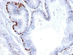 Cystatin A Mouse anti-Human, Clone: CPTC-CSTA-1, Novus Biologicals 100
