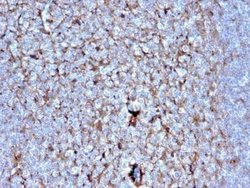 Cystatin A Antibody (CSTA/2882) - Azide and BSA Free, Novus Biologicals