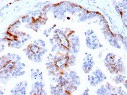 Cystatin A Antibody (CSTA/2882) - Azide and BSA Free, Novus Biologicals