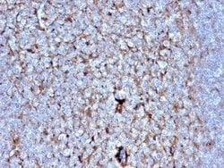 Cystatin A, Mouse anti-Human, Clone: CSTA/2882, Novus Biologicals 20 ug;