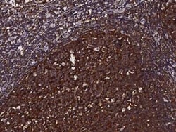 Cystatin A Antibody, Novus Biologicals:Antibodies:Primary Antibodies