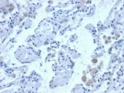 Cystatin B/Stefin B Mouse anti-Human, Clone: CPTC-CSTB-3, Novus Biologicals