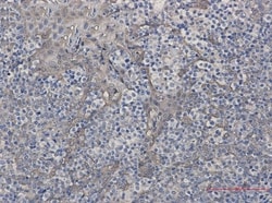 Cystatin B/Stefin B Antibody (S02-7D7), Novus Biologicals 100 &mu;g; Unconjugated:Antibodies,
