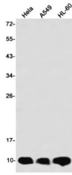 Cystatin B/Stefin B Antibody (S02-7D7), Novus Biologicals 100 &mu;g; Unconjugated:Antibodies,