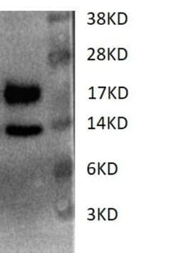 Cystatin E/M/CST6 Antibody (RM0217-6F49), Biotin, Novus Biologicals 0.1mL:Antibodies,