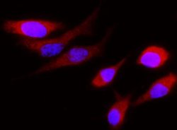 Cystatin S Rabbit anti-Human, Clone: 6, Novus Biologicals 100 &mu;g; Unconjugated:Antibodies,