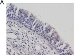 Cystatin SN Antibody, Novus Biologicals 0.05 mg | Buy Online | Novus Biologicals | Fisher Scientific
