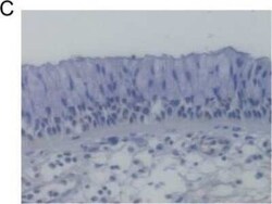 Cystatin SN Antibody, Novus Biologicals 0.05 mg | Buy Online | Novus Biologicals | Fisher Scientific
