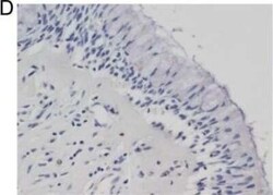 Cystatin SN Antibody, Novus Biologicals 0.05 mg | Buy Online | Novus Biologicals | Fisher Scientific
