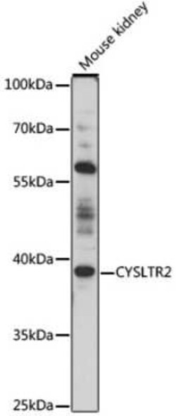 Cysteinyl Leukotriene R2/CysLTR2 Antibody - Azide and BSA Free, Novus Biologicals