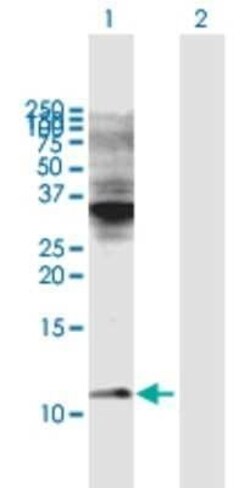 Cytochrome C Oxidase subunit 6c Antibody, Novus Biologicals 0.05 mg | Buy Online | Novus Biologicals | Fisher Scientific