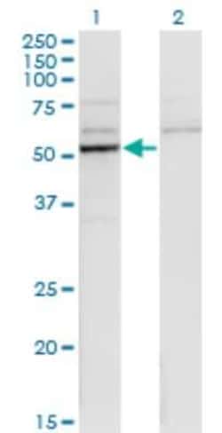 Novus Biologicals Cytochrome P450 26B1 Antibody (1H6), Novus Biologicals 0.1 mg | Buy Online | Novus Biologicals&trade; | Fisher Scientific