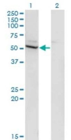 Cytochrome P450 26B1 Antibody (2G7), Novus Biologicals 0.1 mg | Buy Online | Novus Biologicals | Fisher Scientific