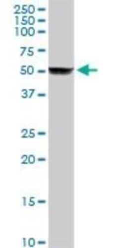 Cytochrome P450 2A6 Antibody, Novus Biologicals 0.1 mg | Buy Online | Novus Biologicals | Fisher Scientific