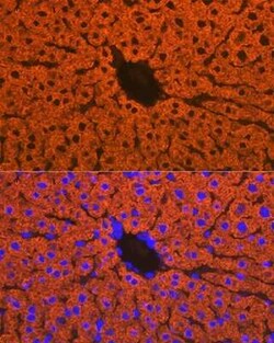 Cytochrome P450 2D6 Rabbit anti-Human, Mouse, Rat, Clone: 1X3F0, Novus