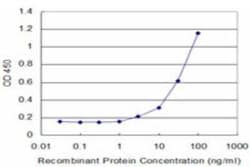 Cytochrome P450 2D6 Antibody (2C5), Novus Biologicals 0.1 mg | Buy Online | Novus Biologicals | Fisher Scientific