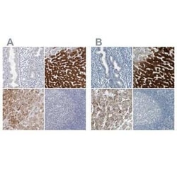 Cytochrome P450 2E1 Antibody, Novus Biologicals 25 &mu;L | Buy Online | Novus Biologicals | Fisher Scientific