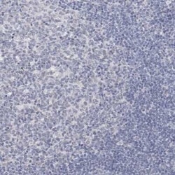 Cytochrome P450 2E1 Antibody, Novus Biologicals 25 &mu;L | Buy Online | Novus Biologicals | Fisher Scientific