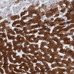 Cytochrome P450 2E1 Antibody, Novus Biologicals 25 &mu;L | Buy Online | Novus Biologicals | Fisher Scientific