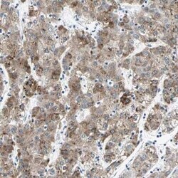 Cytochrome P450 2E1 Antibody, Novus Biologicals:Antibodies:Primary Antibodies