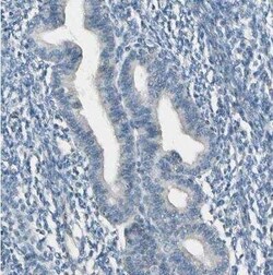 Cytochrome P450 2E1 Antibody, Novus Biologicals:Antibodies:Primary Antibodies