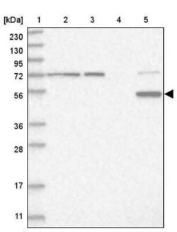 Cytochrome P450 2E1 Antibody, Novus Biologicals 25 &mu;L | Buy Online | Novus Biologicals | Fisher Scientific