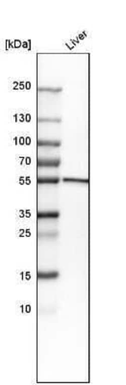 Cytochrome P450 2E1 Antibody, Novus Biologicals:Antibodies:Primary Antibodies