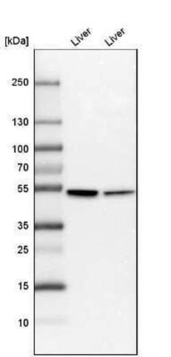 Cytochrome P450 2E1 Antibody, Novus Biologicals:Antibodies:Primary Antibodies