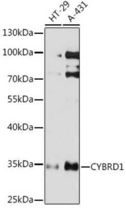 Cytochrome b reductase 1 Rabbit anti-Human, Polyclonal, Novus Biologicals:Antibodies:Primary
