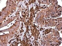 Cytochrome b245 alpha Antibody, Novus Biologicals 100 &mu;g | Buy Online | Bio-Techne | Fisher Scientific