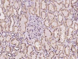 Cytochrome b5 Outer Mitochondrial Membrane Antibody, Novus Biologicals:Antibodies:Primary