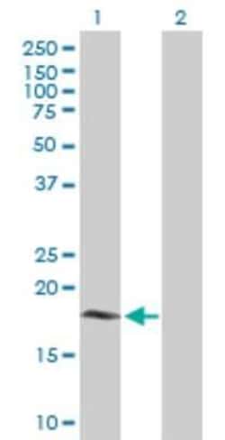 Cytochrome b5 Outer Mitochondrial Membrane Antibody, Novus Biologicals