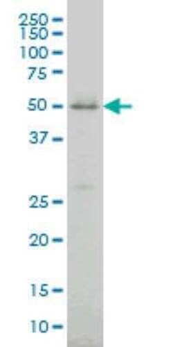 Cytochrome p450 2J2 Antibody (2D10), Novus Biologicals 0.1 mg | Buy Online | Novus Biologicals | Fisher Scientific