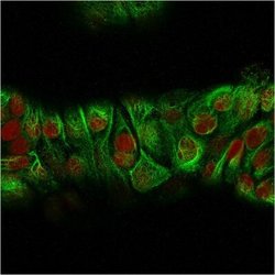 Cytokeratin, HMW Antibody (KRTH/2147R) - Azide and BSA Free, Novus Biologicals 100 &mu;g | Buy Online | Novus Biologicals | Fisher Scientific