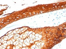 Cytokeratin, HMW Antibody (KRTH/4392R) - Azide and BSA Free, Novus Biologicals 100 &mu;g | Buy Online | Novus Biologicals | Fisher Scientific