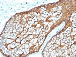 Cytokeratin, HMW Antibody (rKRTH/6617) - Azide and BSA Free, Novus Biologicals 100 &mu;g | Buy Online | Novus Biologicals | Fisher Scientific