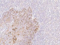 Cytokeratin, HMW Antibody, Novus Biologicals 50 &mu;g, Unconjugated:Antibodies,