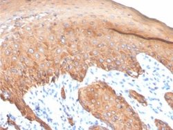 Cytokeratin, LMW Rabbit anti-Human, Clone: KRTL/4440R, Novus Biologicals:Antibodies:Primary