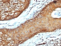 Cytokeratin, LMW Antibody (rKRTL/6616) - Azide and BSA Free, Novus Biologicals 100 &mu;g | Buy Online | Novus Biologicals | Fisher Scientific