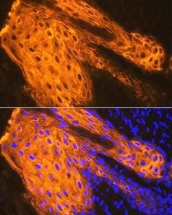 Cytokeratin 1 Rabbit anti-Human, Mouse, Rat, Clone: 10W8J6, Novus Biologicals