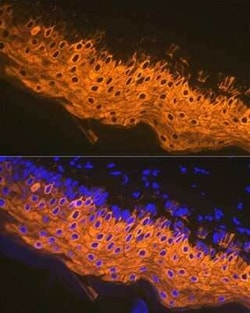 Cytokeratin 1 Rabbit anti-Human, Mouse, Rat, Clone: 10W8J6, Novus Biologicals