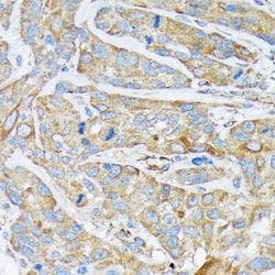 Cytokeratin 1 Rabbit anti-Human, Mouse, Rat, Clone: 10W8J6, Novus Biologicals