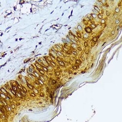 Cytokeratin 1 Rabbit anti-Human, Mouse, Rat, Clone: 10W8J6, Novus Biologicals