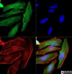 Cytokeratin 1 Antibody (LHK1) - Azide and BSA Free, Novus Biologicals 0.1