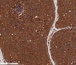 Cytokeratin 1 Antibody (LHK1) - Azide and BSA Free, Novus Biologicals 0.1