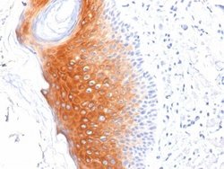 Cytokeratin 1 Antibody (LHK1) - Azide and BSA Free, Novus Biologicals 100