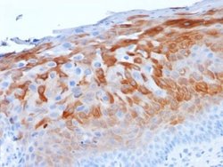 Cytokeratin 1 Mouse anti-Human, Rat, Clone: LHK1, Novus Biologicals 20 &mu;g | Buy Online | Novus Biologicals | Fisher Scientific