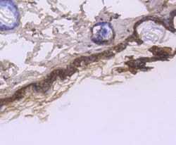 Cytokeratin1 Rabbit anti-Human, Clone: SN72-08, Novus Biologicals 100&mu;L:Antibodies,