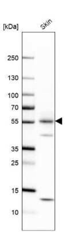 Cytokeratin 1 Antibody, Novus Biologicals 25 &mu;L, Unconjugated:Antibodies,