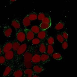Cytokeratin 10/13 Antibody (DE-K13), Novus Biologicals 0.02mg; Unlabeled:Antibodies,